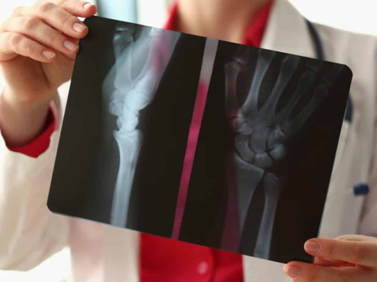 آلمان به چی معروفه؟